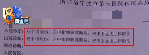 刷屏!被玻璃门割伤手的“小张”引来百万网友帮忙“维权”! 刷屏!被玻璃门割伤手的“小张”引来百万网友帮忙“维权”!